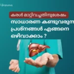 കരൾ മാറ്റിവച്ചതിനുശേഷം എന്തെല്ലാം ശ്രദ്ധിക്കണം?