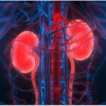 Chronic Renal Diseases